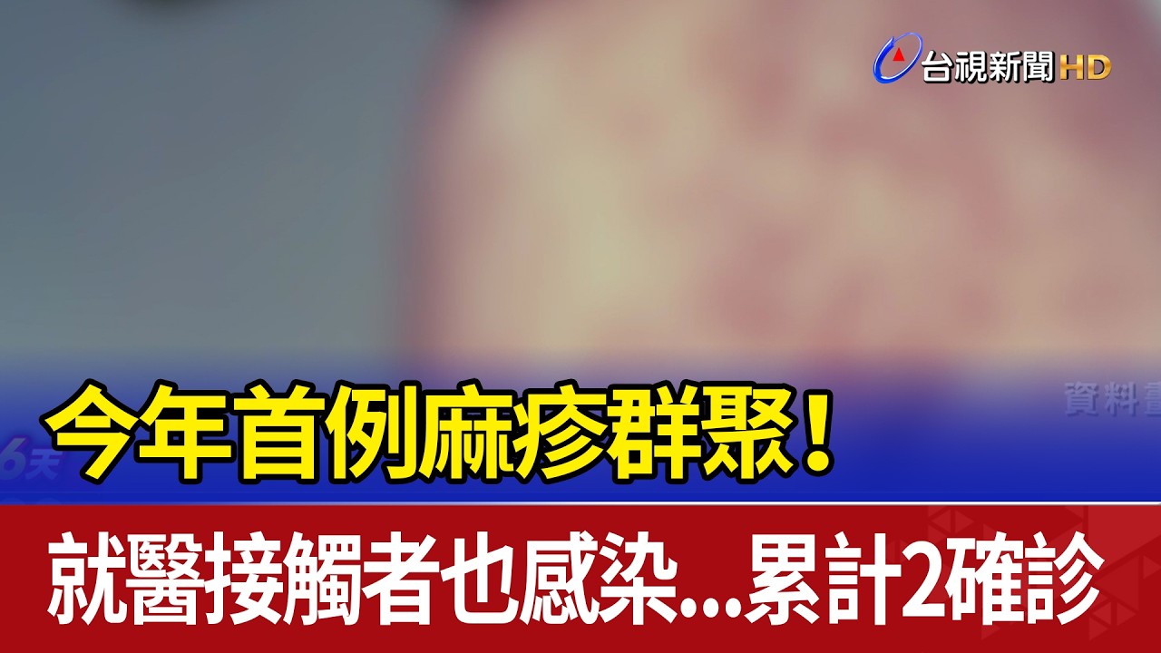 今年首例麻疹群聚！ 就醫接觸者也感染...累計2確診