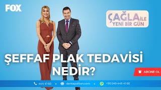 Şeffaf Plak (invisalign) Tedavisi İle ilgili Merak Edilenler, Çağla Şikel'in Sunumuyla.