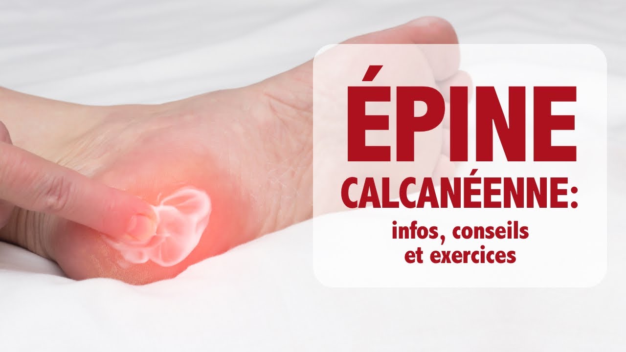 Épine calcanéenne (de Lenoir): informations, conseils et exercices