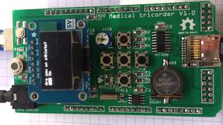 Medical Tricoder - Heart Rate Measurement