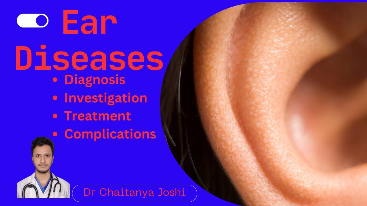 Ear infections, otitis media Loksewa Entrance MBBS/MD/MS and PSC in