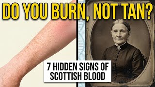 7 Hidden Signs Your Family Has Scottish Blood
