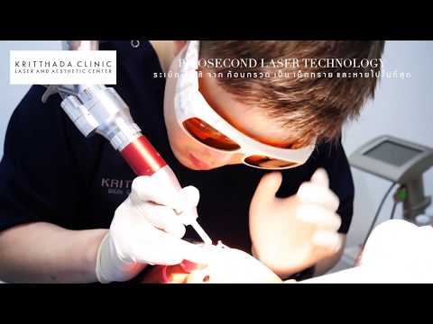 Picosecond Laser นวัตกรรมเลเซอร์ใหม่ล่าสุดที่ KritthadaClinic