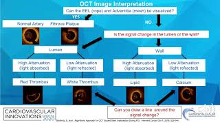 OCT-guided PCI: step-by-step_Shlofmitz_Coronary On Demand screenshot 4