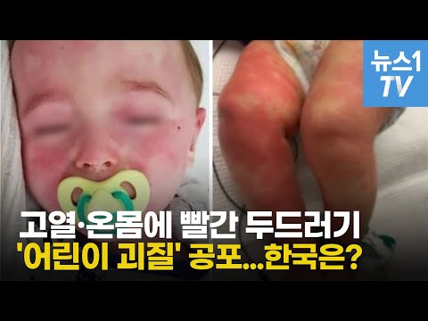 괴질 사망자 코로나 양성...&amp;#39;어린이 괴질&amp;#39; 공포 일파만파