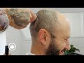 Head Shave Transforms Balding Guy's Look