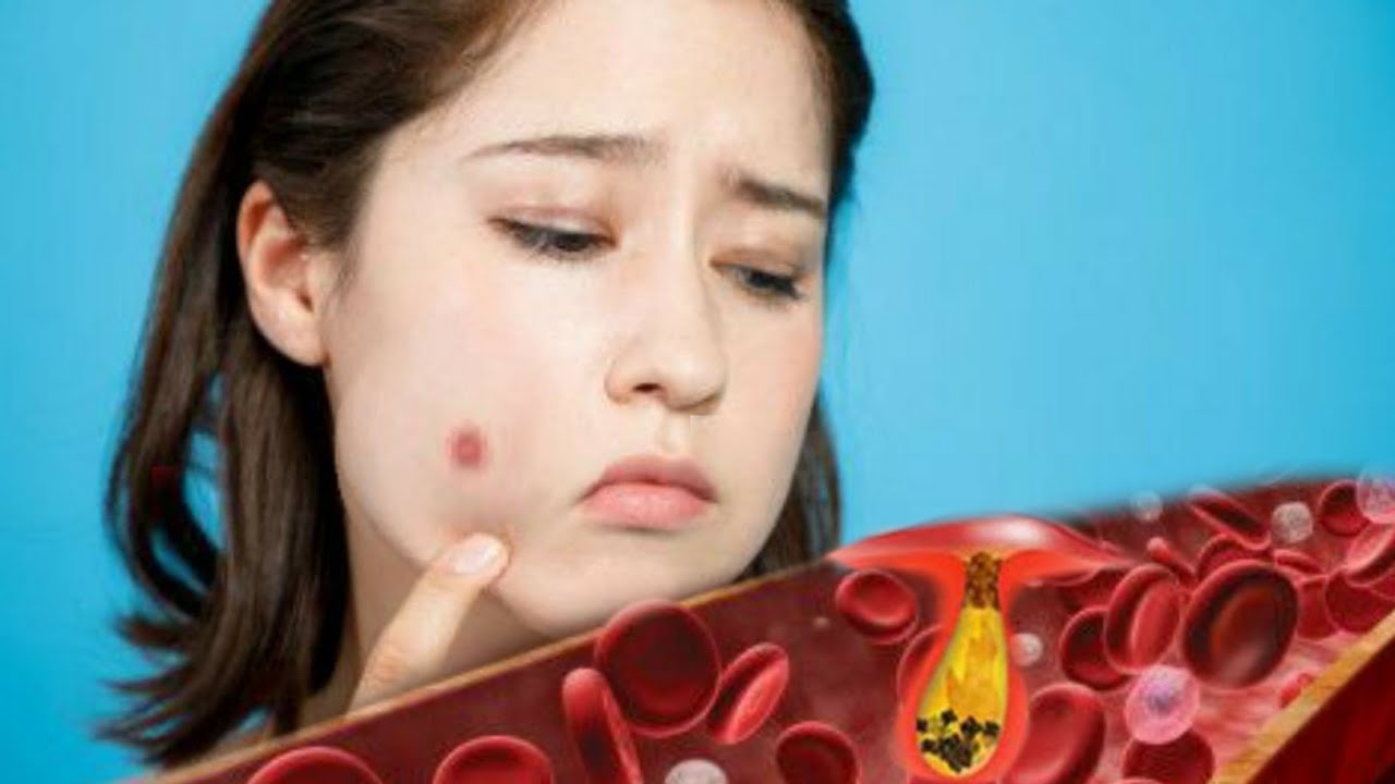 Cara Alami Membersihkan Darah Kotor Dari Dalam Tubuh Dan Paling Ampuh