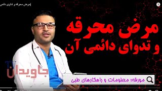 مرض محرقه و تداوی دائمی آن| داکتر قیس نیکزاد