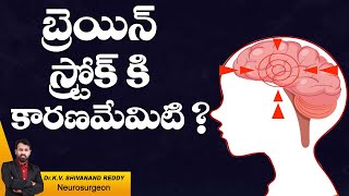 Hi9 | బ్రెయిన్ స్ట్రోక్‌కి కారణమేమిటి? | Dr .KV Shivanand Reddy, Neurosurgeon