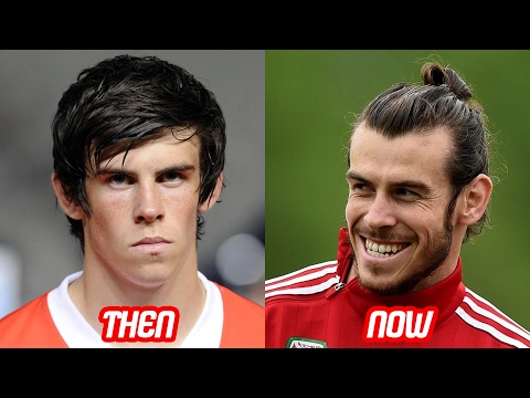 Gareth Bale, Pedazo Melena, Calvicie y su Extraño Múscu 