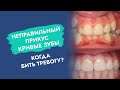 Неправильный прикус. Кривые зубы. Когда бить тревогу?