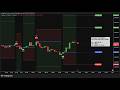 🔴LIVE XAU/USD TRADING SIGNALS | FOLLOW YOUR RISK | SESSION #3