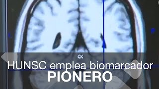 El Hospital La Candelaria emplea un biomarcador pionero en Canarias