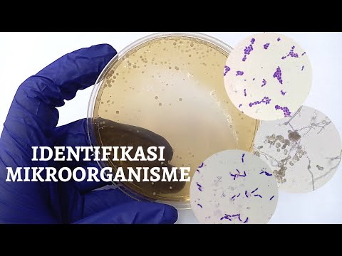 Video: Saat melakukan layar biru putih koloni bakteri putih mengandung?