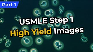 USMLE Step 1 High Yield Images (Part 1)