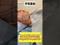 頬と顎下の脂肪吸引!手術直後も大公開!#shorts #脂肪吸引