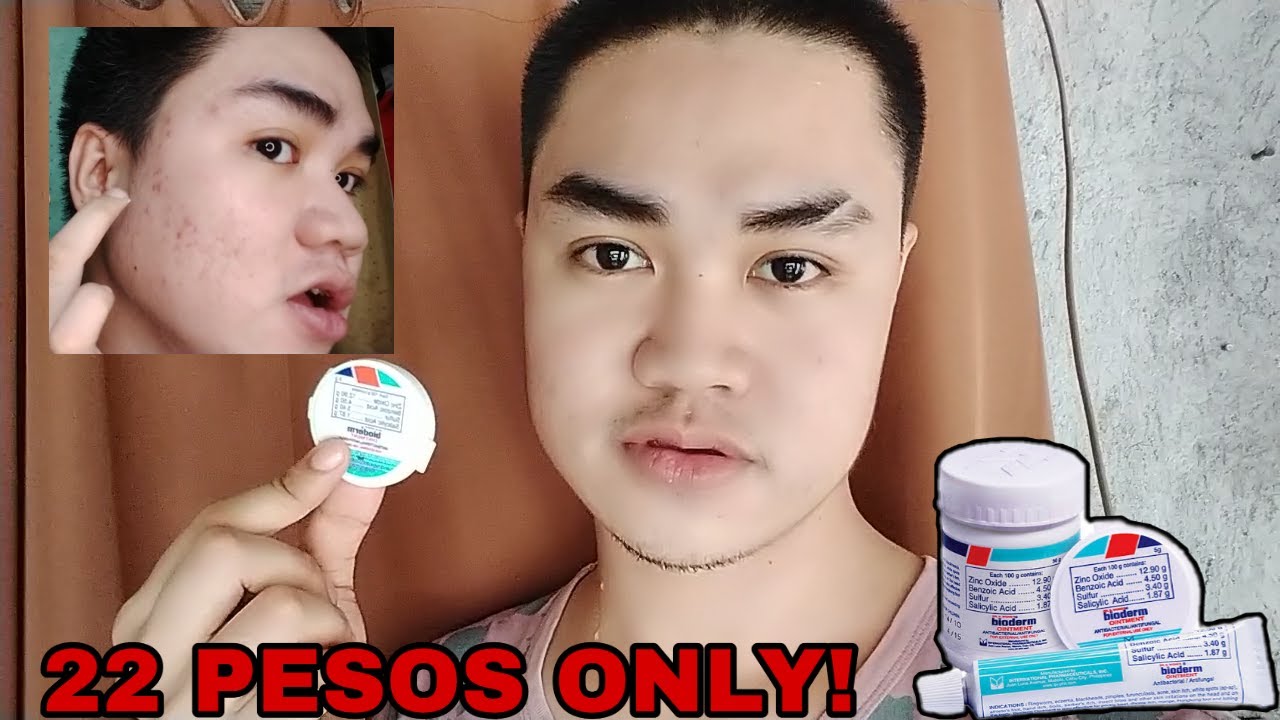BIODERM OINTMENT REVIEW 2020 JonMagat YouTube