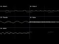 Jup - Quirky Puzzle Music: Type A (8-bit NES Chiptune | Famitracker 2A03)