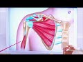 Повреждение мышц плеча - частая и болезненная патология