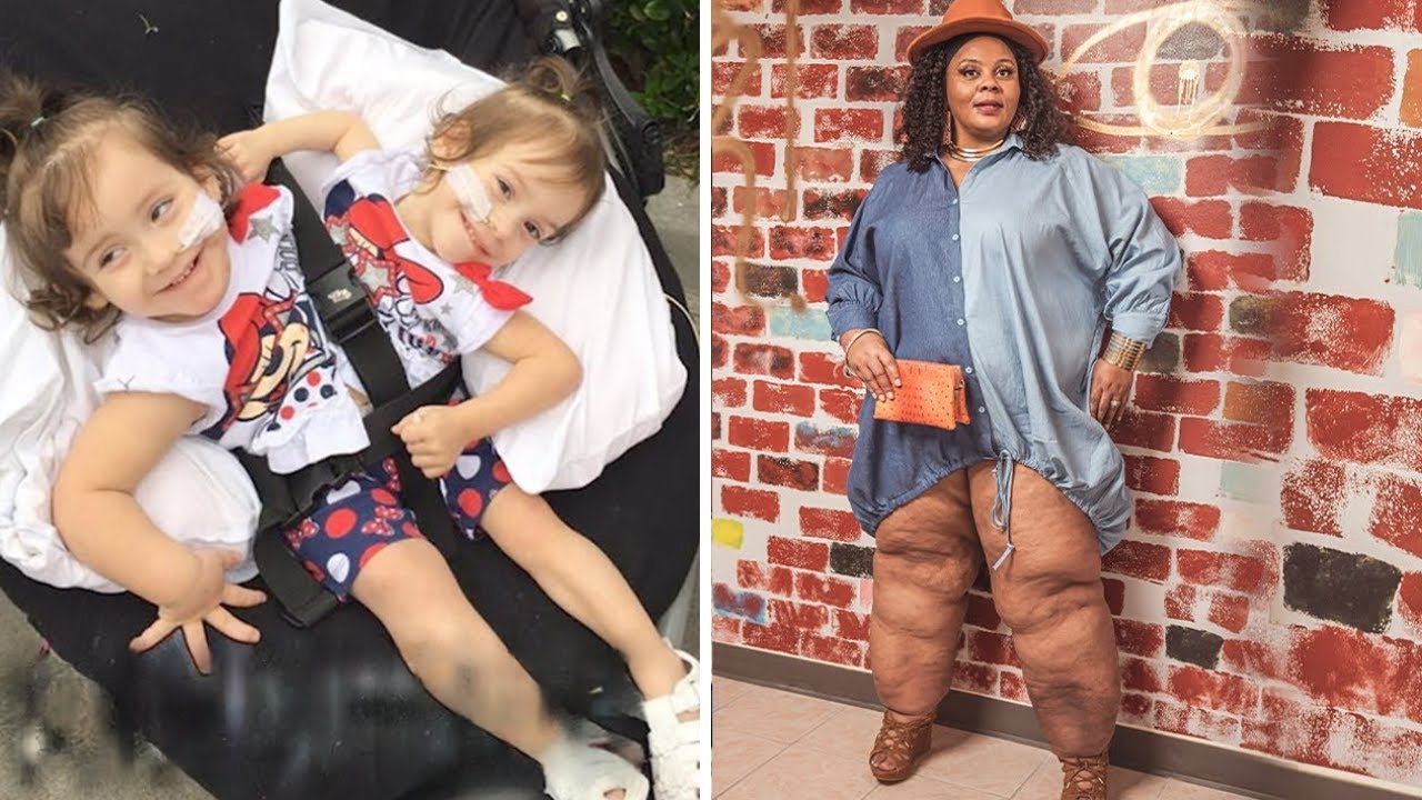 15 необычных и редких людей, которые встречаются один на миллион