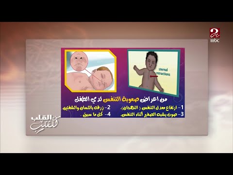 فيديو: هل يستطيع الطفل أن يبصق ويختنق؟