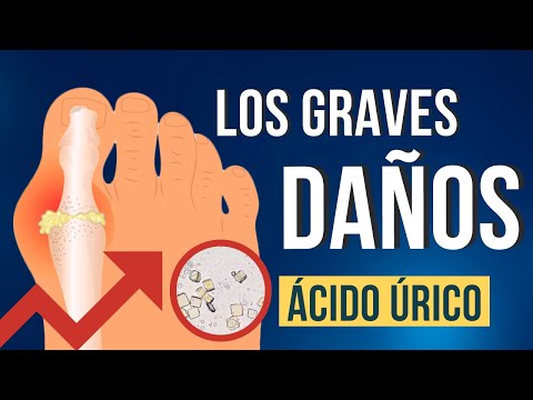 Huevos y acido urico