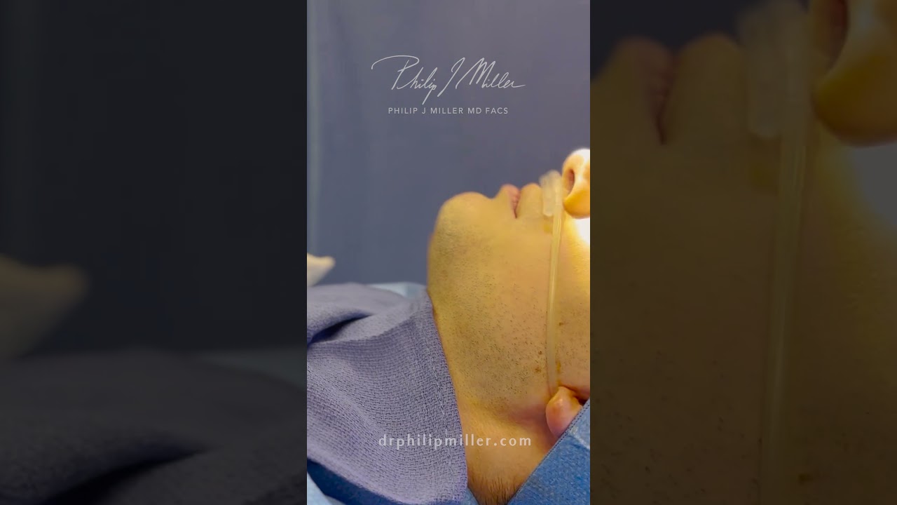The Importance Of Sizing During A Chin Implant Surgery