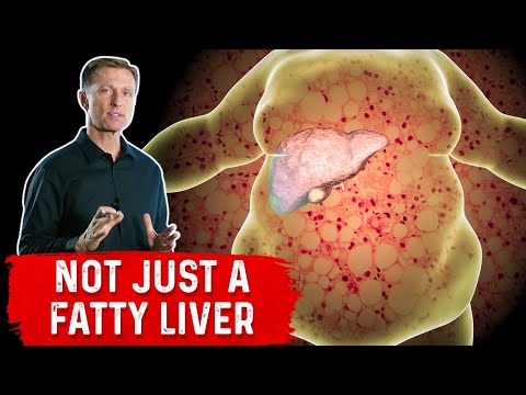 A Fatty Liver Spreads to All of Your Organs