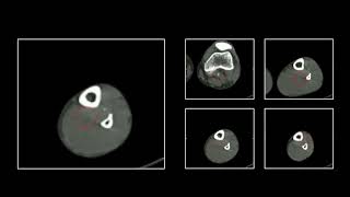 CTA Extremity Pt. 2 | Free Radiology CME