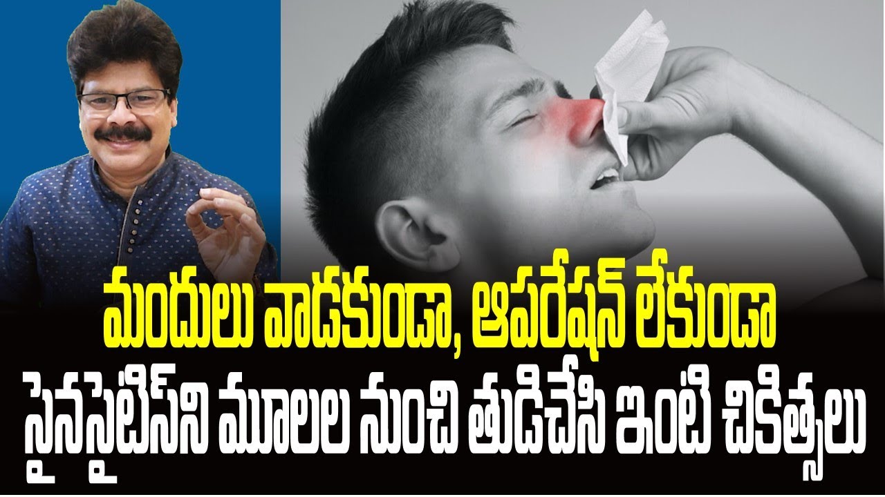 మందులు వాడకుండా ఆపరేషన్ లేకుండా సైనసైటిస్‌ని మూలల నుంచి తుడిచేసి ఇంటి చికిత్సలు!Sinusitis Treatments