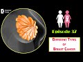 DIFFERENT TYPES OF BREAST CANCER - Know More !!! - Dr. Sandeep Nayak | Samrohana | Doctors