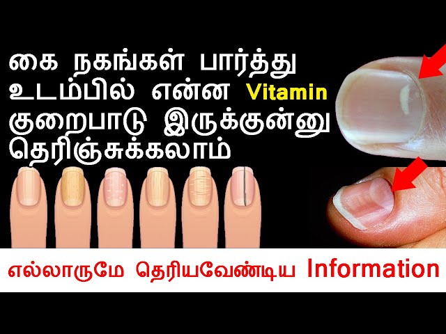 நைல் பாலிஷ் உபகோயிப்பதால் ஏற்படும் விளைவுகள்/அறிவியல் விளக்கம்/nail polish  side effects/Tamil/Tkheal - YouTube