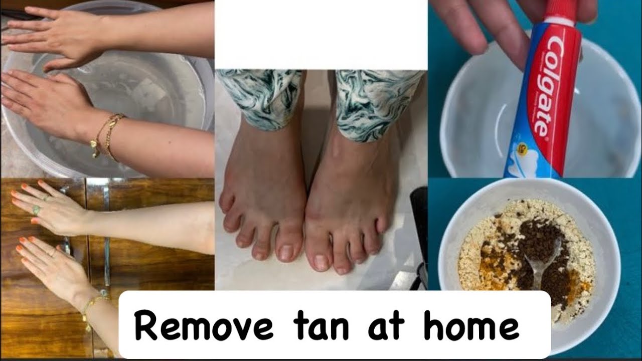 Hand Tan Removal “Get Tan-free , Brighter Hands 100% Effective Home remedies 💅💯 - YouTube