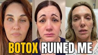 The Dark Side of Botox 😱Nobody Warms You About | Why Hundreds of Women Suddenly Regret Getting Botox