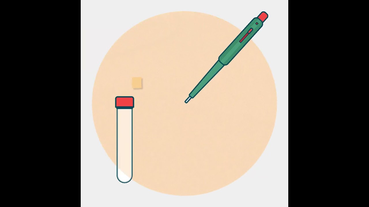 Animated loop