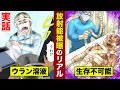 実話 放射能被曝をした男 全身の皮がめくれ上がり 生存不可能 実話 放射能被曝をした男 全身の皮がめくれ上がり 生存不可能