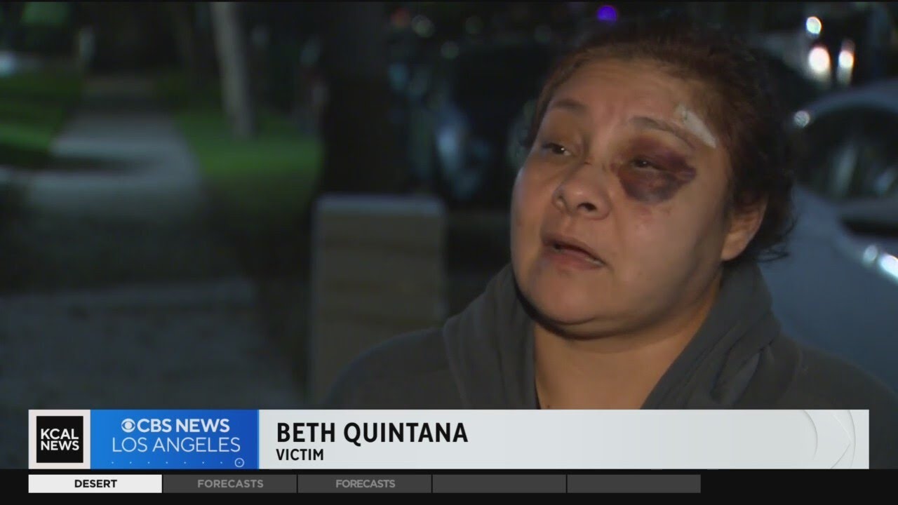 Long Beach woman fights off assault and robbery suspect