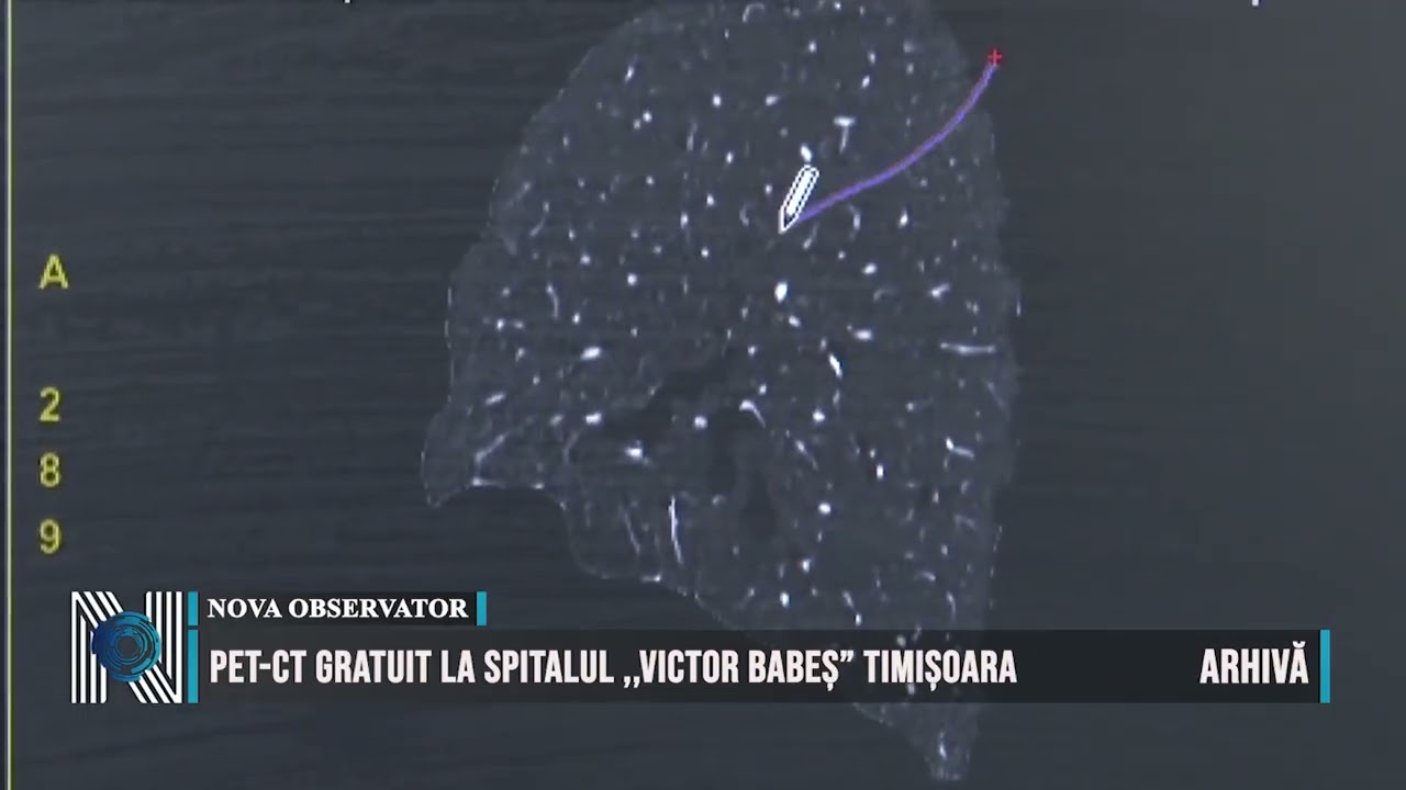 PET-CT gratuit la Spitalul ,,Victor Babeș” Timișoara