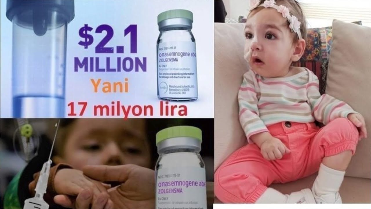 متى تظهر أعراض ضمور العضلات الشوكي على الطفل؟.. تفاصيل الكشف والعلاج