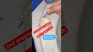 Getting Pregnant with PCOS 💔➡️💖 | My Real Struggle &amp; Hope…