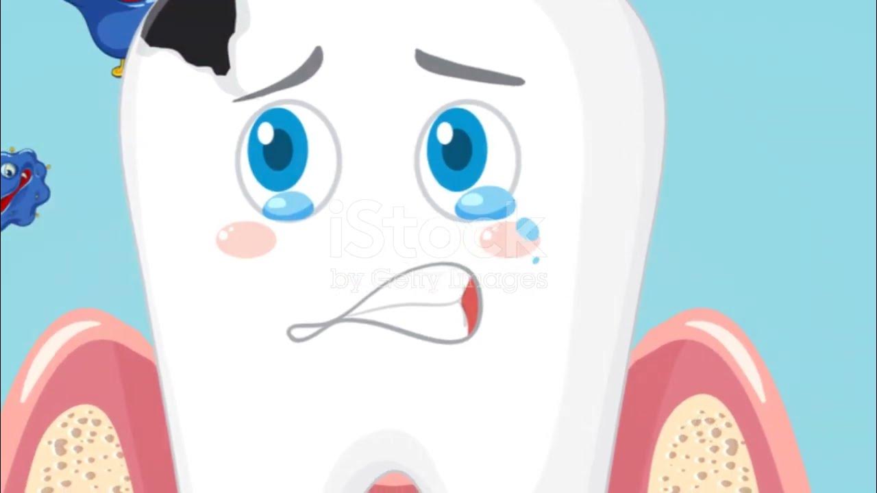 Dental Abcess Why Root Canal Treatment Is Needed YouTube