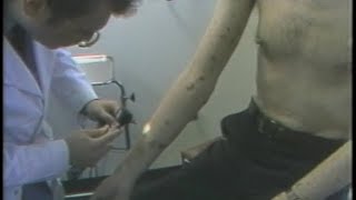 1983 REPORT: Diagnosis ( EARLY AIDS DOCUMENTARY )