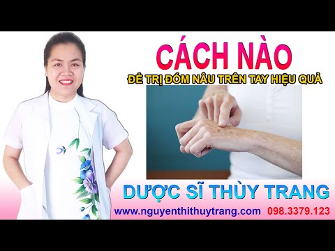 Video: Làm thế nào để đông lạnh các đốm đen?