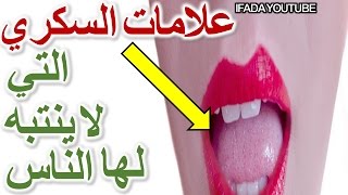 عشرة علامات مرض السكري المبكرة التي لم تكن تعرفها! لكل من لا يريد ان يعاني من مرض السكري