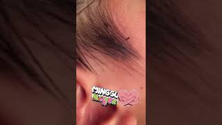 liceinfestation974 #headliceremoval #licecomb #headlice #headlicetreatment #hairlice #haircare #hair