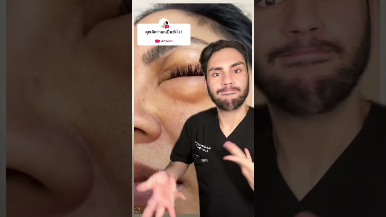 Viral TikTok Video Carboxytherapy For Dark Circles | What Was The Reason | MaximumSkin