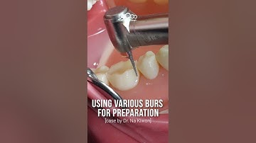 Using Various Burs for Preparation #dentalbean
