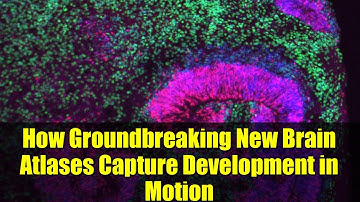 How Groundbreaking New Brain Atlases Capture Development in Motion