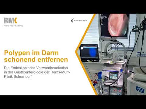 Video: Wie entferne ich adenomatöse Polypen?