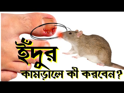 ইঁদুরে কামড়ালে কী হয়? | What happens if rat bites Us?